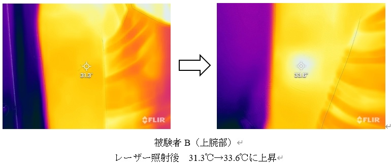 ライフ上腕女