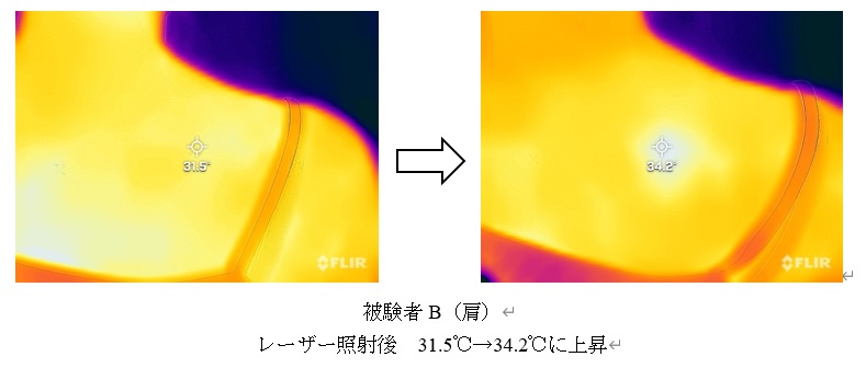 肩に30分　31.5℃→34.2℃