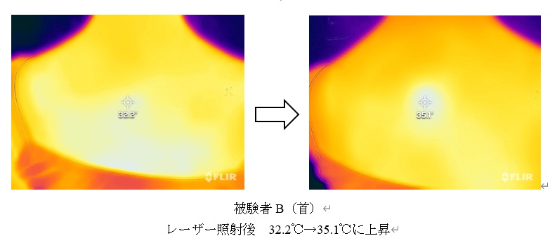 女性首当たり32.2℃から35.1℃へ
